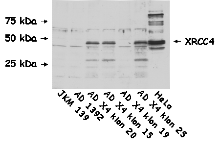 western XRCC4